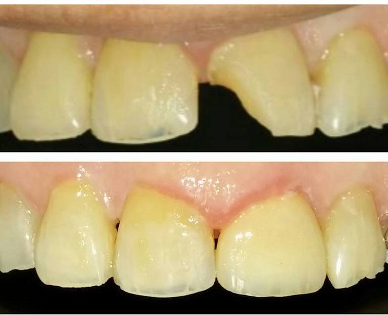 odontologia estetica